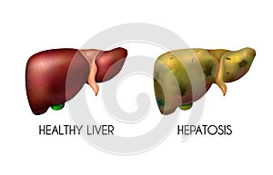 Realistic Human Internal Organs Liver Healthy Normal Unhealthy Fatty Composition