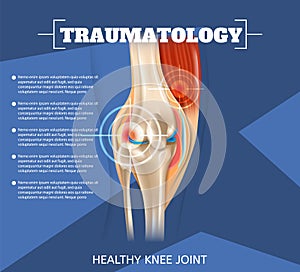 Realistic Illustration Traumatology Medicine in 3d