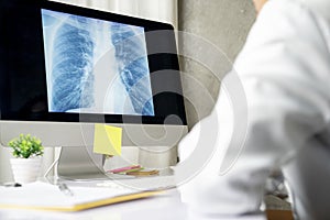 Rear of Doctor looking at lung X-rays