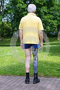 Rear view on man with prosthetic leg
