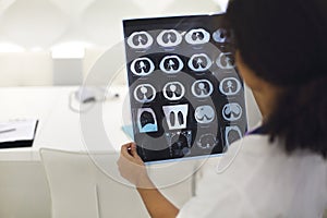 Rearview of ethnic female doctor analyzing X-ray or MRI scan while working in hospital, selective focus. Physician looking at CT