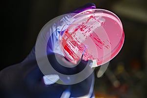 Reasercher picking up colony of a red bacterial culture from pink fluorescent compound treated agar plate  in a molecular biology