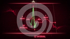 QRS Complex from Electrocardiogram Wave or ECG or EKG photo