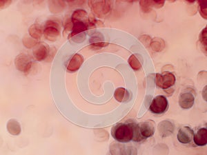 Red background with round shape looking like blood cells