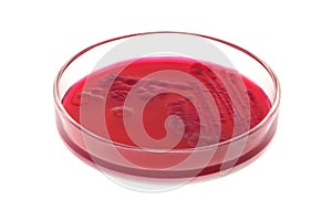 Red bacterial colonies on petri dish red agar isolated