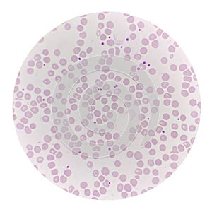 Red blood cell with Platelet in blood smear