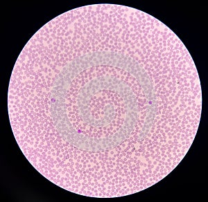 Red blood cell and white blood cells in 40X microscope