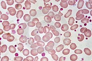 Red blood cells