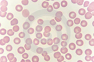 Red blood cells in blood smear