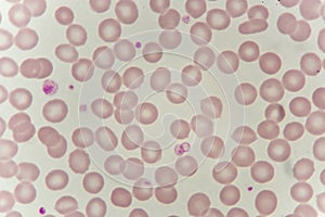Red blood cells in blood smear