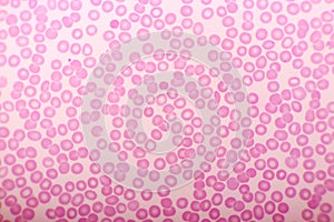 Red blood cells in blood smear