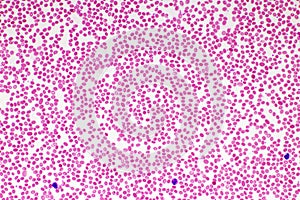 Red blood cells in blood smear