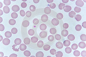 Red blood cells and platelet in blood smear