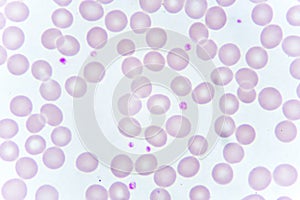 Red blood cells and platelet in blood smear