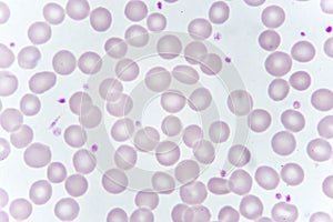 Red blood cells and platelet in blood smear