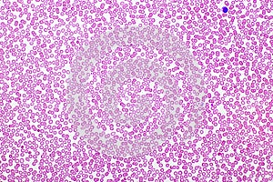 Red blood cells and platelet in blood smear