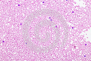 Red blood cells and platelet in blood smear