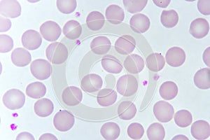 Red blood cells and platelet in blood smear photo