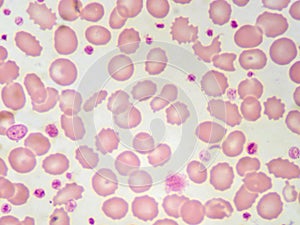 Red blood cells