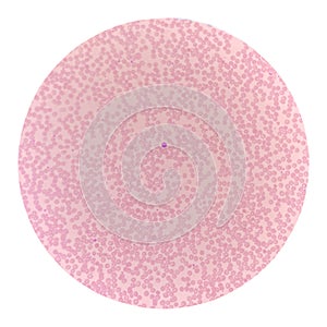 Red blood cells in blood smear on white background