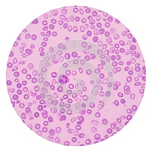 Red blood cells on white background