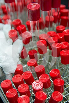 Red capped test tubes