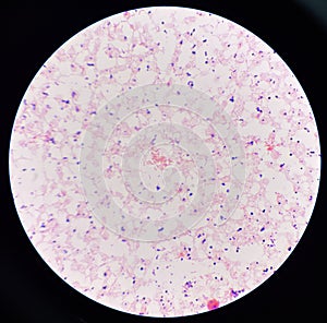 Red cell gram negative bacilli in hemo culture