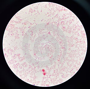 Red cell gram negative bacilli in hemo culture