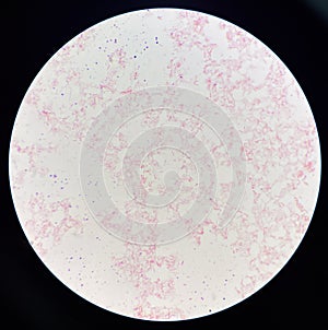 Red cell gram negative bacilli in hemo culture