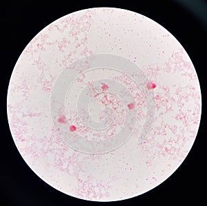 Red cell gram negative bacilli in hemo culture