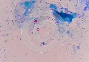 Red cells cryptosporidium oocyte