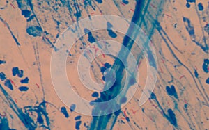 Red cells microbacterium tuberculosis