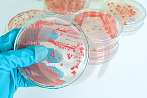 Red colony of becteria in petridish
