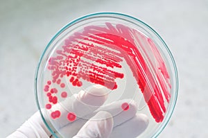 Red colony in petridish