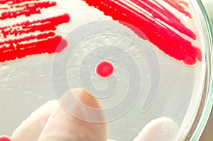 Red colony in petridish