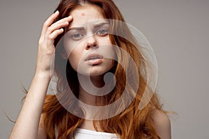 red-haired woman cosmetology skin care puberty light background