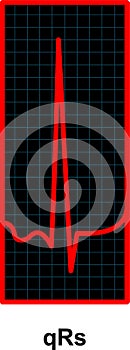 Red Heartbeat Pulse Monitor. EKG and Cardio symbol