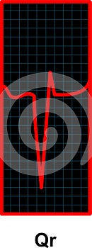 Red Heartbeat Pulse Monitor. EKG and Cardio symbol