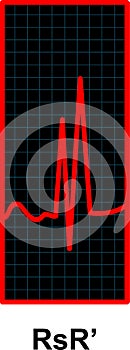 Red Heartbeat Pulse Monitor. EKG and Cardio symbol