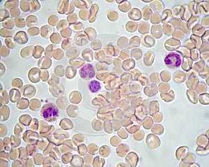 Red humnan cells and white cells, under optical microscope 1000x magnification