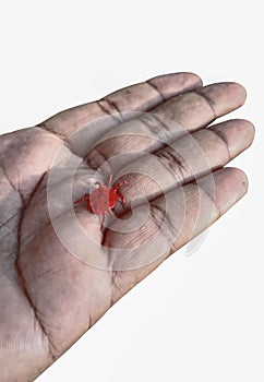 RED MITE ON A HAND