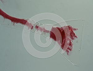 Red polyp stick under the microscope