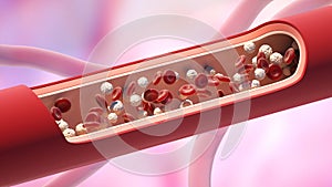 Red and white blood cells in the vein. Leukocyte high level