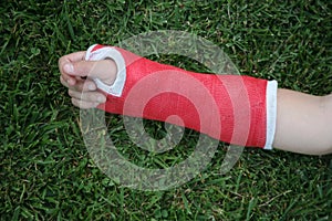 Red wrist arm and hand cast photo