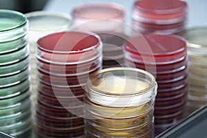 Red and yellow petri dishes stacks in microbiology lab on the bacteriology laboratory background.