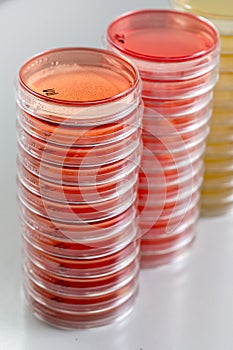 Red and yellow petri dishes stacks in microbiology lab on the bacteriology laboratory background. photo