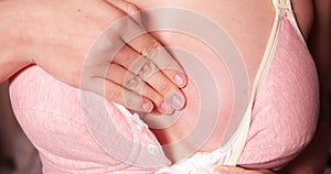 reddened breast feeding mothers. Close-up of a girl breast suffering from mastitis or lactostasis. slow motion