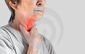 Redness at neck of Asian woman. Concept of sore throat, pharyngitis, laryngitis, thyroiditis, or dysphagia