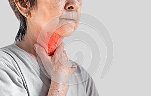 Redness at neck of Asian woman. Concept of sore throat, pharyngitis, laryngitis, thyroiditis, or dysphagia photo