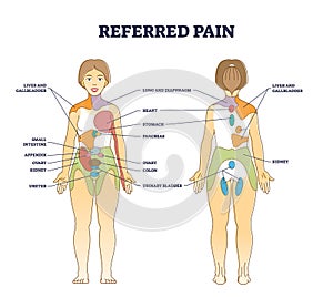 Referred pain location as body painful stimulus organ origin outline diagram